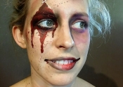 zombiebruised
